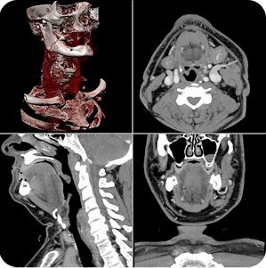 CT Imaging